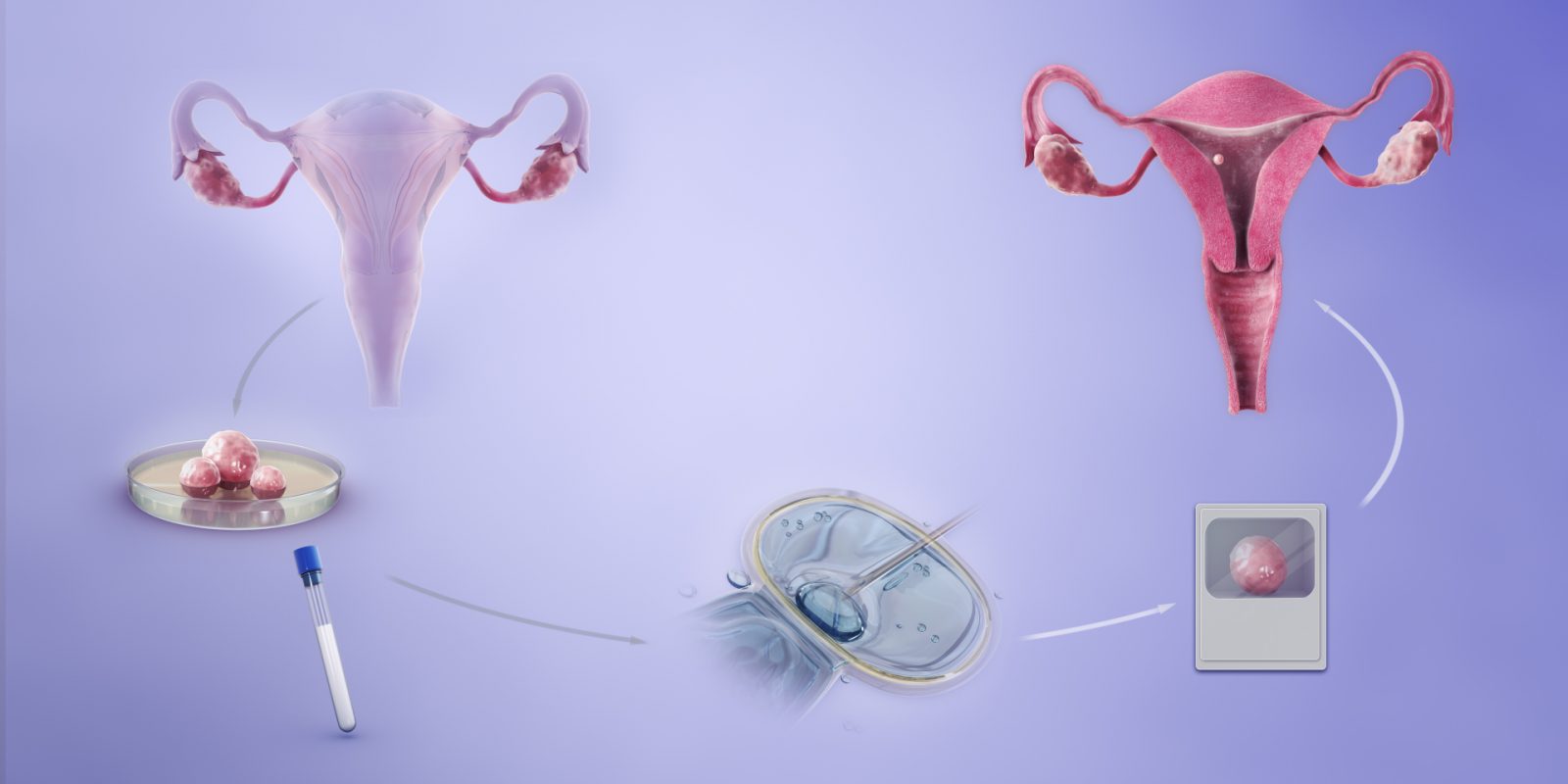 Different Types of IVF and Cost Associated To It