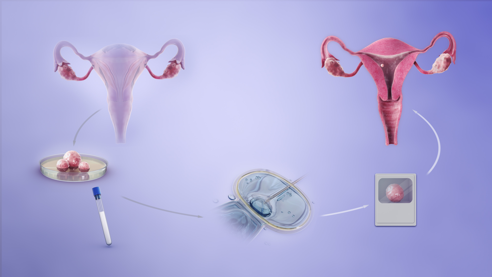 Different Types of IVF and Cost Associated To It