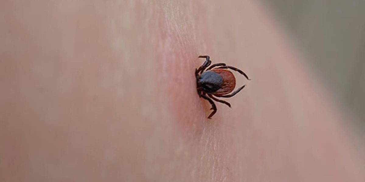 How To Remove A Tick